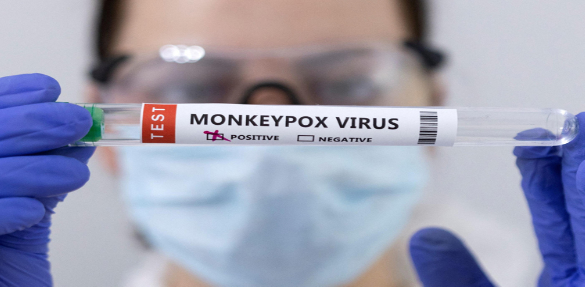 780 casos de viruela del mono en 27 países según OMS.