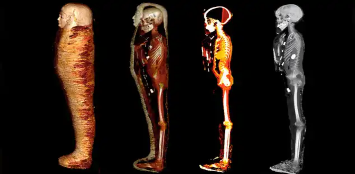 Momia de un «niño de oro» fue analizada digitalmente y se encontraron con 49 amuletos preciosos