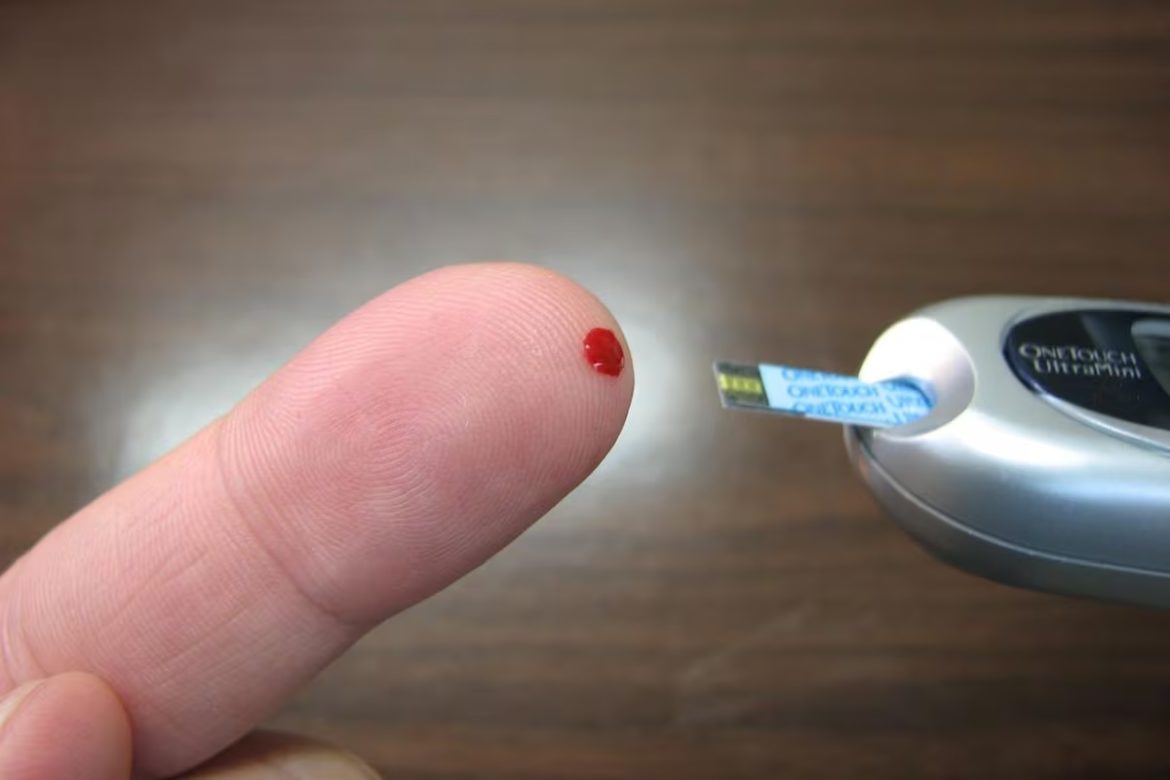 Una gota de sangre de la yema del dedo podría servir para detectar el alzhéimer